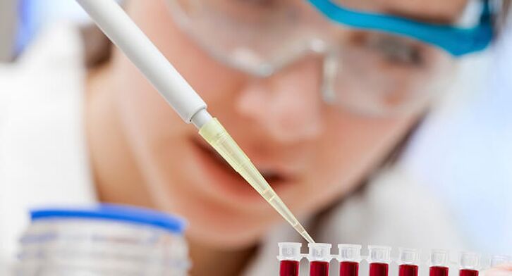 exames de sangue para artrose do quadril