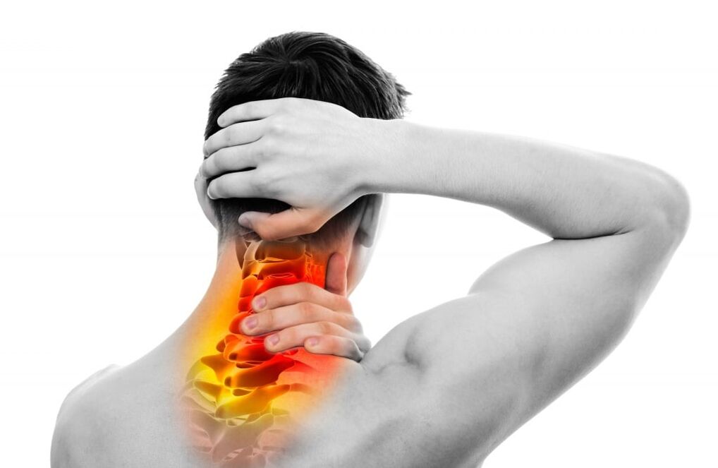 sintomas de osteocondrose cervical