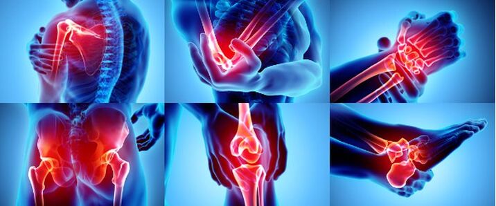 Articulações inflamadas